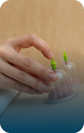 Hijama Therapy